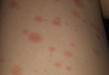 Can I go to Amsterdam without Covid vaccine? Can I go to Amsterdam without Covid vaccine?