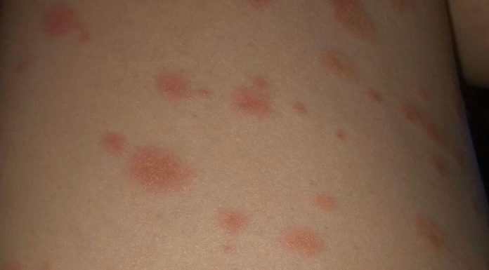 Can I go to Amsterdam without Covid vaccine? Can I go to Amsterdam without Covid vaccine?