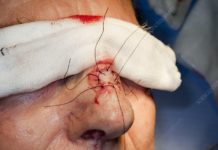 Can I use euros in Basel? Can I use euros in Basel?