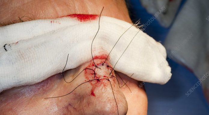 Can I use euros in Basel? Can I use euros in Basel?