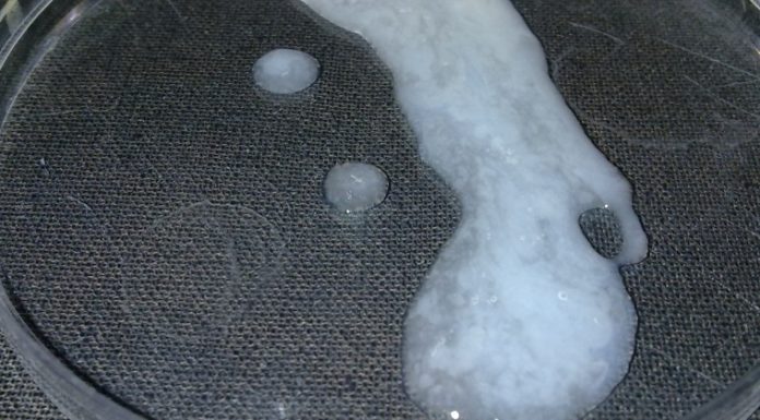 Can onion increase sperm? Can onion increase sperm?