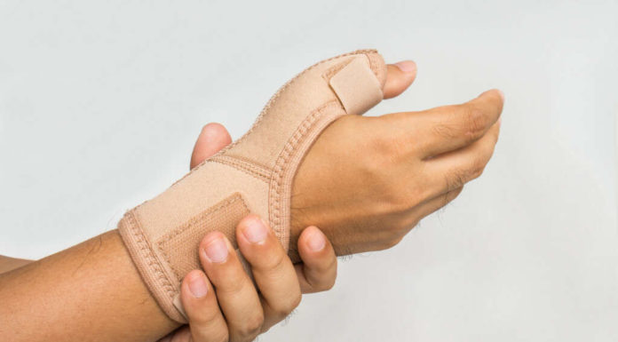 Can psoriasis go away? Can psoriasis go away?