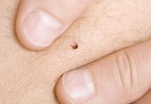 Comment se faire tester pour la maladie de Lyme ? Comment se faire tester pour la maladie de Lyme ?