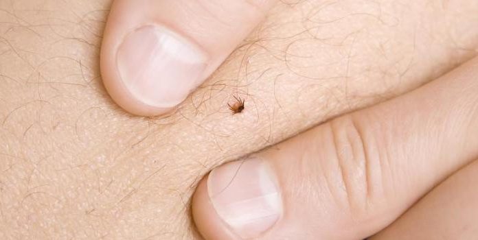 Comment se faire tester pour la maladie de Lyme ? Comment se faire tester pour la maladie de Lyme ?