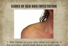 Do 5 star hotels have bed bugs? Do 5 star hotels have bed bugs?