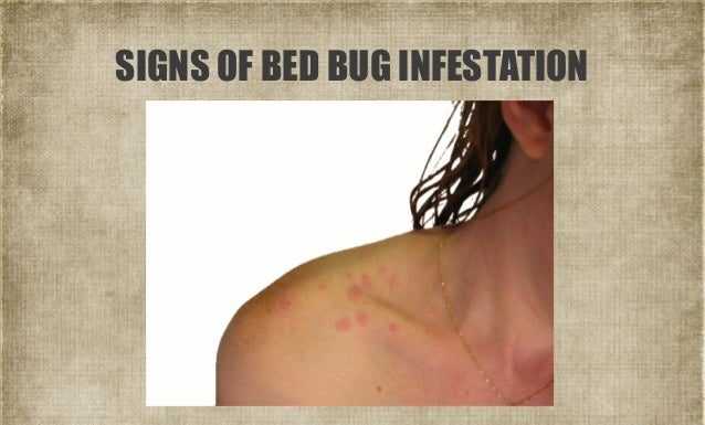 Do 5 star hotels have bed bugs? Do 5 star hotels have bed bugs?