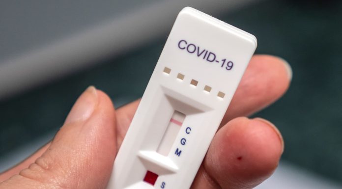 Do I need a Covid test to connect in Frankfurt? Do I need a Covid test to connect in Frankfurt?