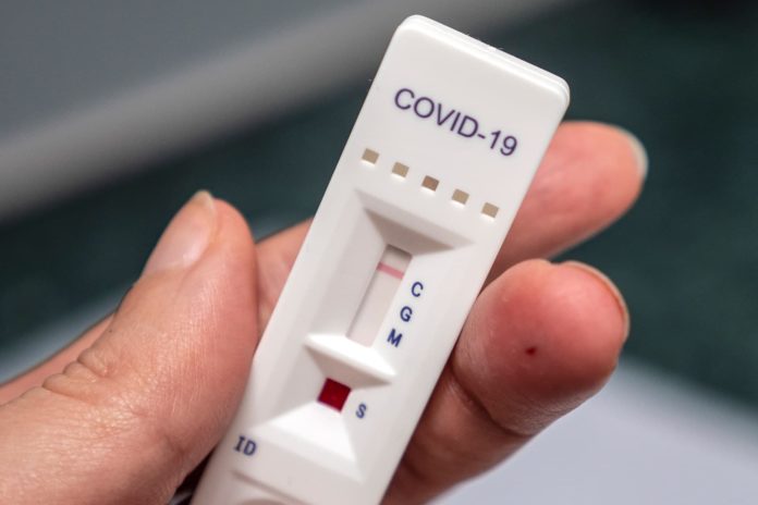 Do I need a Covid test to connect in Frankfurt?