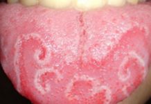 Does Google map work in Ireland? Does Google map work in Ireland?