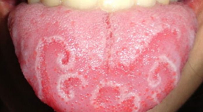 Does Google map work in Ireland? Does Google map work in Ireland?