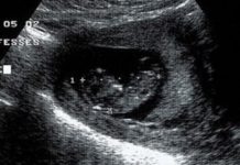 Does Mossel Bay fall under Western Cape? Does Mossel Bay fall under Western Cape?