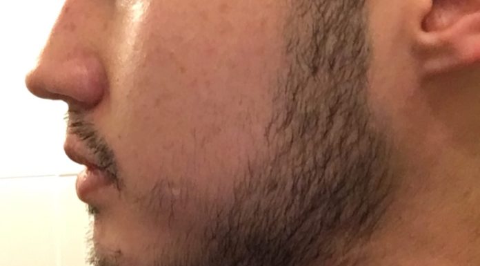 How do I fill my patchy beard? How do I fill my patchy beard?