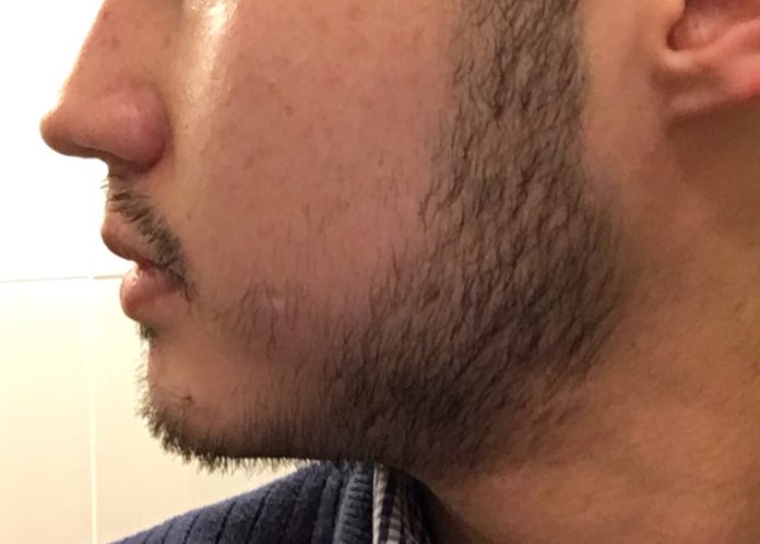 How do I fill my patchy beard?