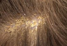 How do you detox your scalp? How do you detox your scalp?