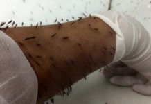 How long does it take to go through ago? How long does it take to go through ago?