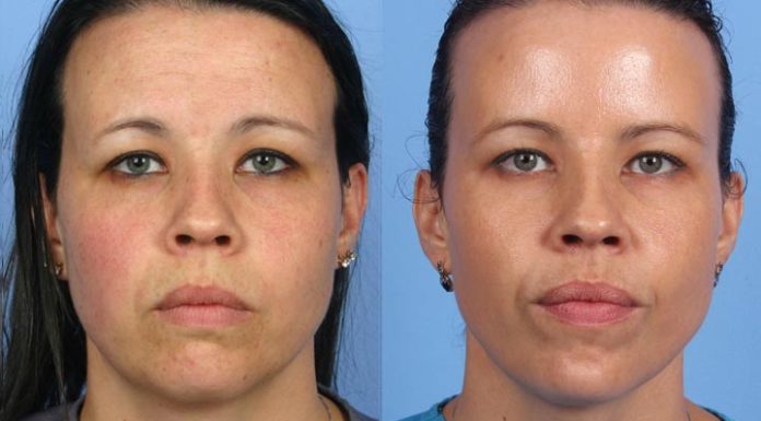 How many days do you need in the Louvre? How many days do you need in the Louvre?