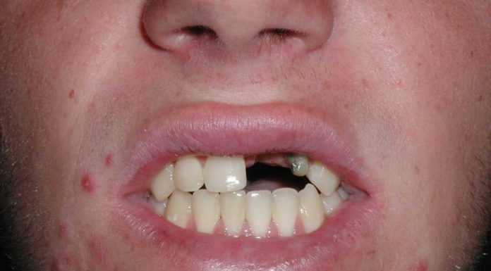 How much do snowshoes cost? How much do snowshoes cost?