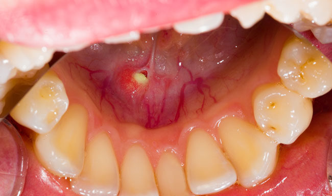 How much does Bangkok massage cost? How much does Bangkok massage cost?