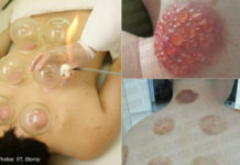 How much is a scalp massage? How much is a scalp massage?