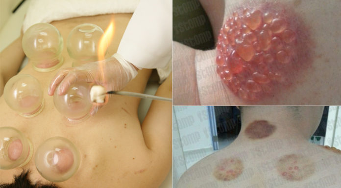 How much is a scalp massage? How much is a scalp massage?