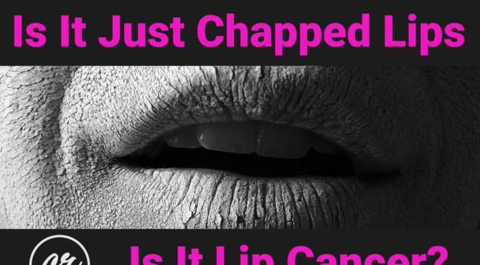 What are the signs you need probiotics? What are the signs you need probiotics?