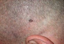 What skin Colour is Nagatoro? What skin Colour is Nagatoro?