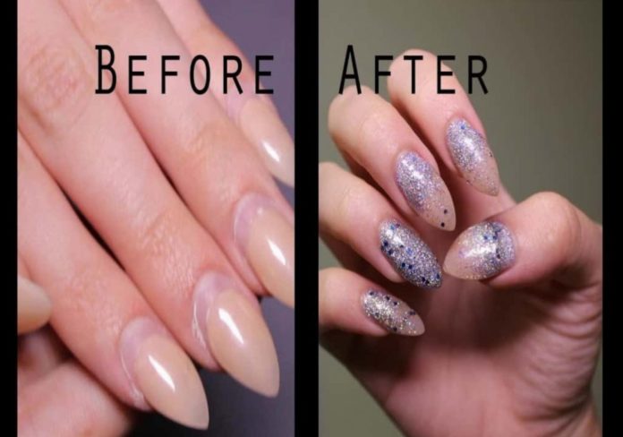 Which is better gel or acrylic?