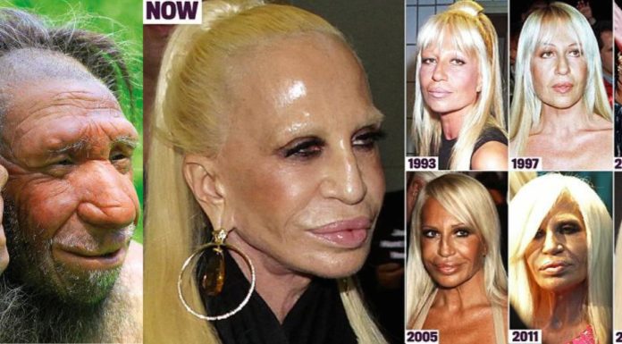 Who is the best plastic surgeon in Iran? Who is the best plastic surgeon in Iran?