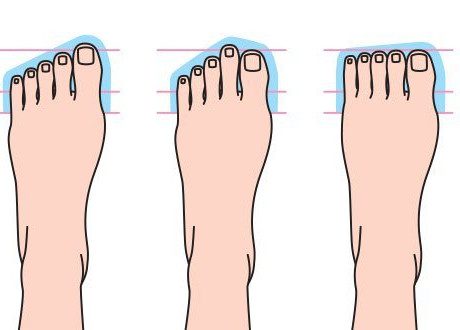 Les différentes formes de pieds